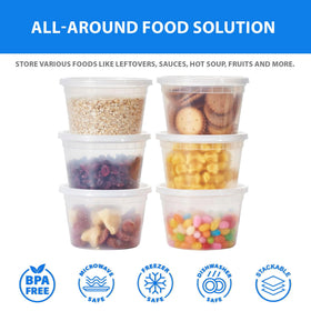 APSIC clear-view containers streamline inventory and service.
